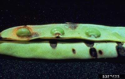 Anthracnose Symptoms In Beans – Managing Bean Plant Anthracnose In Gardens