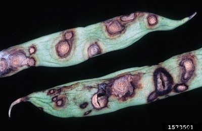 Beans Covered With Spots: Reasons For Brown Spots On Beans