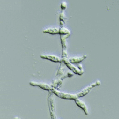 Trichoderma viridae: An Important Plant Protection biological Agent