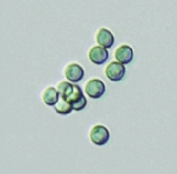 Trichoderma viridae: An Important Plant Protection biological Agent