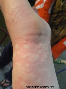 Stinging Nettle: A Medicinal Herb